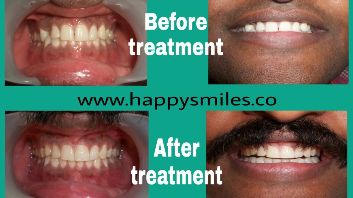 orthodontics
