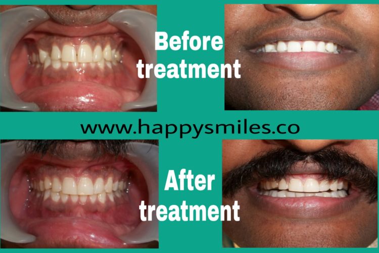 orthodontics
