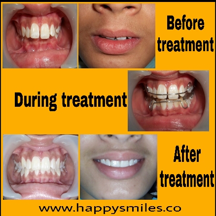 orthodontic