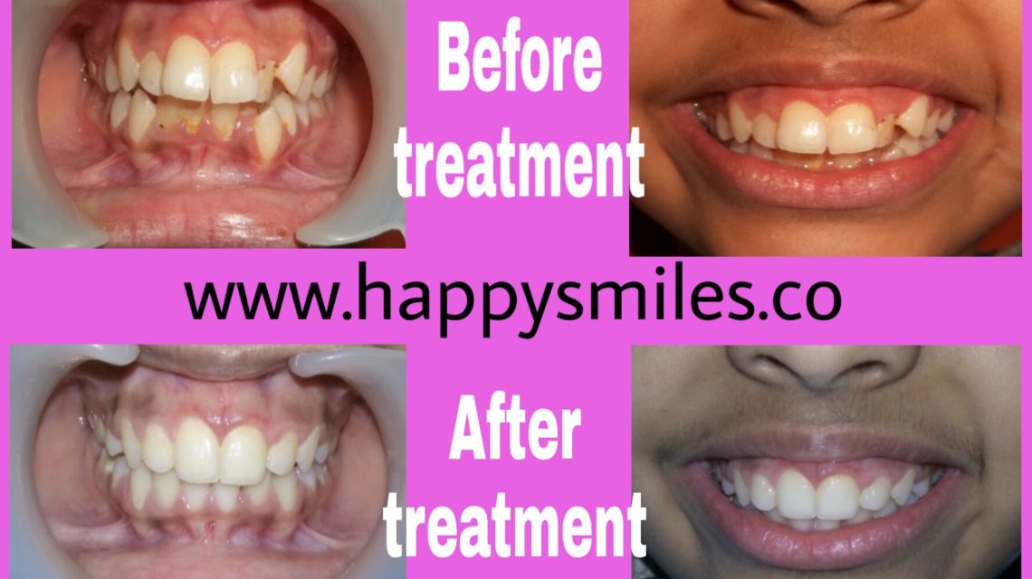 orthodontic