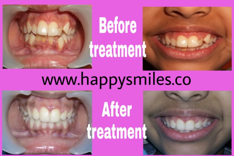 orthodontic