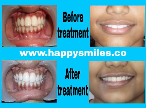 orthodontic
