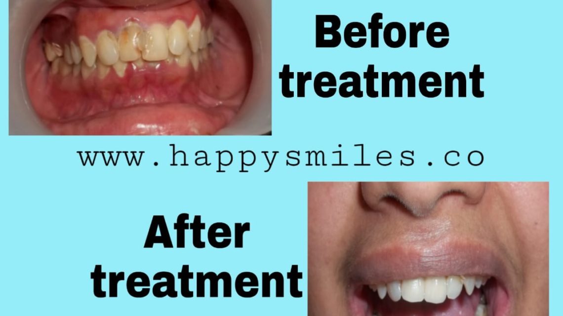 healthy smile