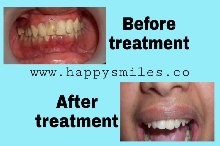 healthy smile