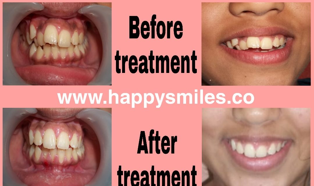 orthodontic