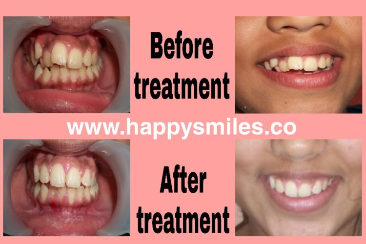 orthodontic