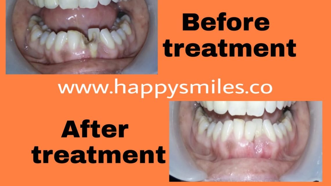 cosmetic dentistry