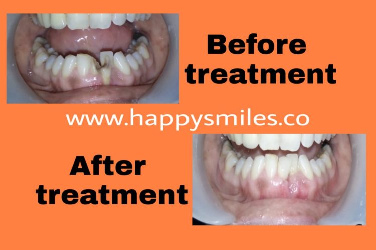 cosmetic dentistry