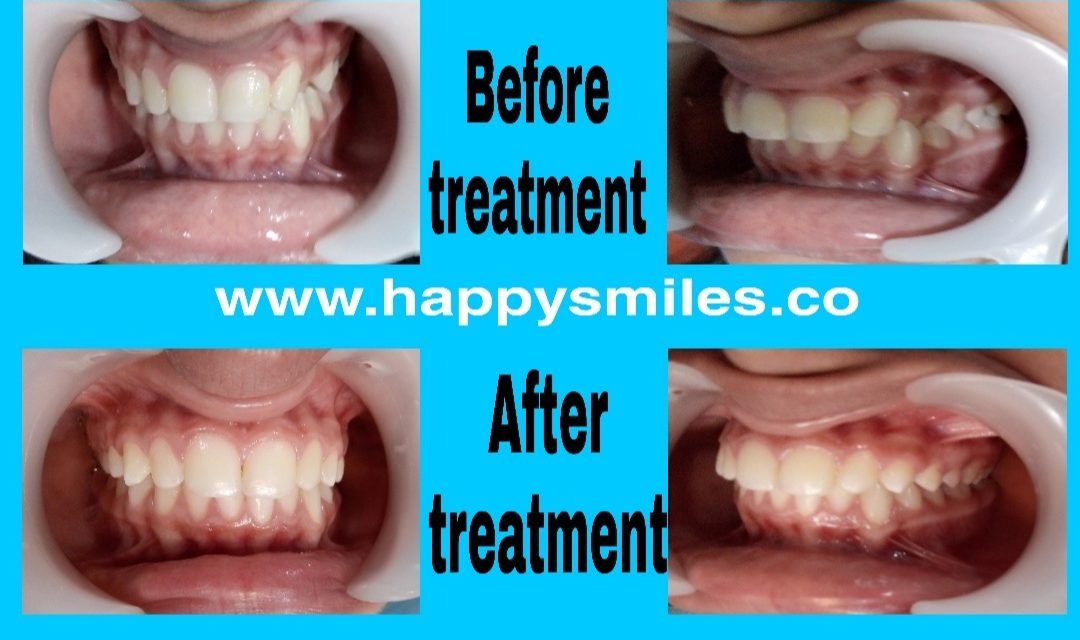 fixed orthodontic