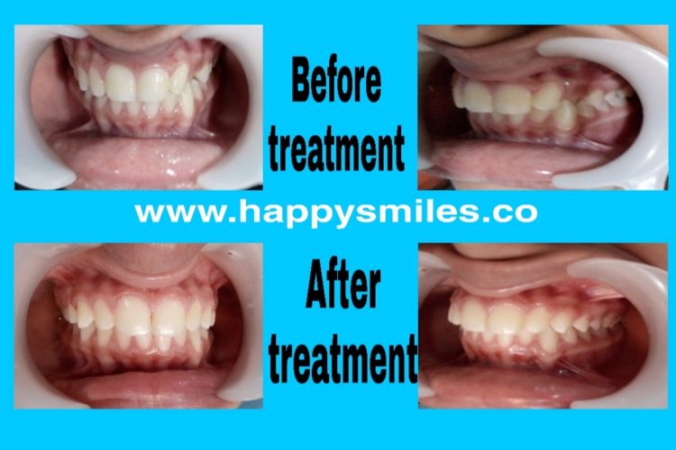 fixed orthodontic