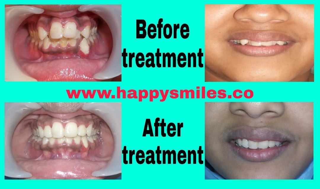 orthodontic