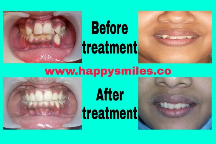 orthodontic