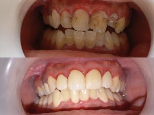 Before and After image